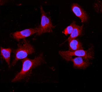 Cytochrome P450 2B6/CYP2B6 Rabbit Polyclonal Antibody