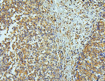 WNT4 Rabbit Polyclonal Antibody
