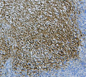 WNT4 Rabbit Polyclonal Antibody