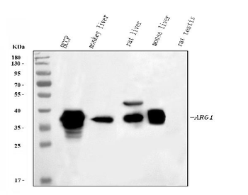 liver Arginase/ARG1 Rabbit Polyclonal Antibody