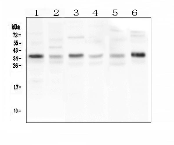 CD40L/CD40LG Rabbit Polyclonal Antibody