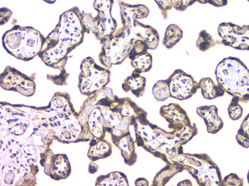 HDAC5 Rabbit Polyclonal Antibody