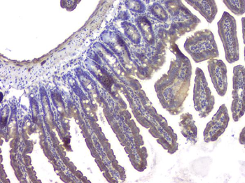 HDAC5 Rabbit Polyclonal Antibody