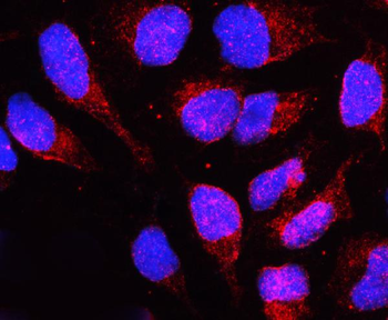 Lamin B Receptor/LBR Rabbit Polyclonal Antibody