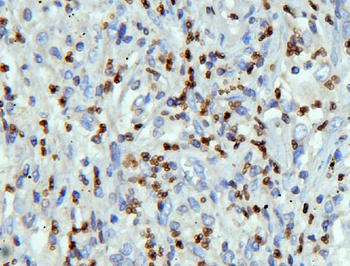 Lamin B Receptor/LBR Rabbit Polyclonal Antibody