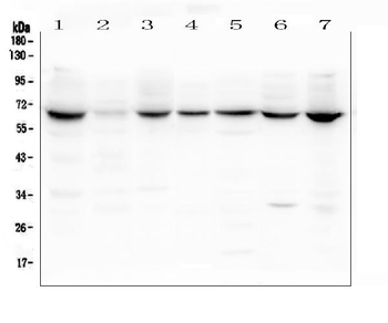 Lamin B Receptor/LBR Rabbit Polyclonal Antibody
