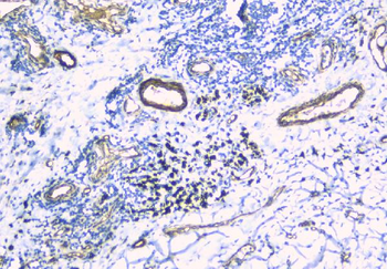 TIE2/TEK Rabbit Polyclonal Antibody