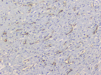 TIE2/TEK Rabbit Polyclonal Antibody