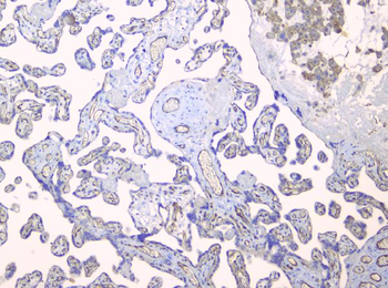 TIE2/TEK Rabbit Polyclonal Antibody