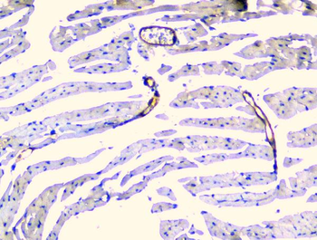 TIE2/TEK Rabbit Polyclonal Antibody