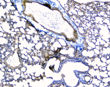 TIE2/TEK Rabbit Polyclonal Antibody