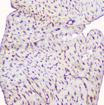 TIE2/TEK Rabbit Polyclonal Antibody