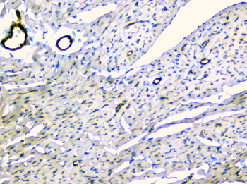 TIE2/TEK Rabbit Polyclonal Antibody