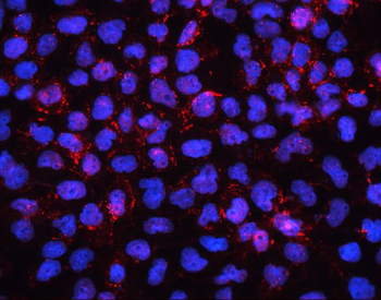 EHD1 Rabbit Polyclonal Antibody