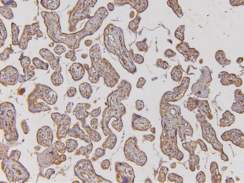 EHD1 Rabbit Polyclonal Antibody