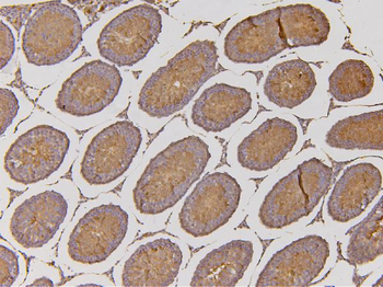 EHD1 Rabbit Polyclonal Antibody