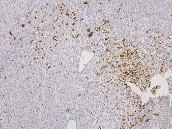 Glycophorin A/GYPA Rabbit Polyclonal Antibody