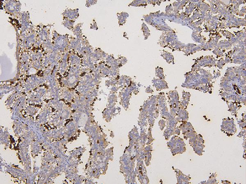 Glycophorin A/GYPA Rabbit Polyclonal Antibody