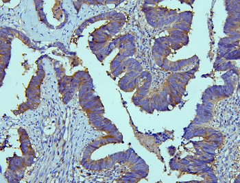 EBP50/NHERF-1/SLC9A3R1/NHERF Rabbit Polyclonal Antibody