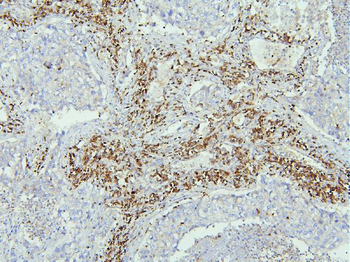 EBP50/NHERF-1/SLC9A3R1/NHERF Rabbit Polyclonal Antibody