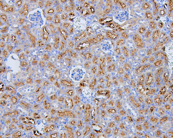 EBP50/NHERF-1/SLC9A3R1/NHERF Rabbit Polyclonal Antibody