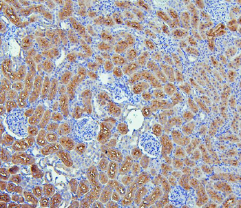 EBP50/NHERF-1/SLC9A3R1/NHERF Rabbit Polyclonal Antibody
