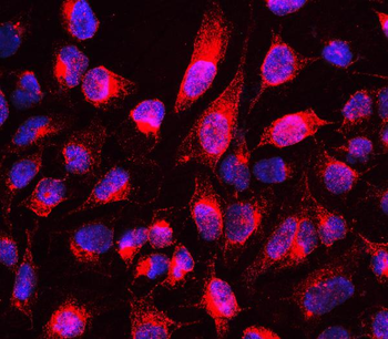 MTUS1 Rabbit Polyclonal Antibody