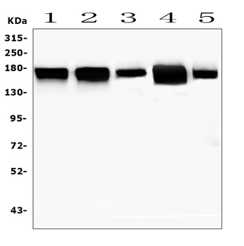 MTUS1 Rabbit Polyclonal Antibody