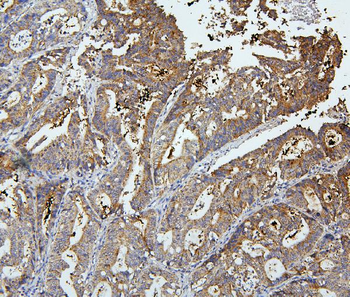 OLFM4 Rabbit Polyclonal Antibody