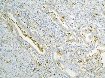 Annexin A3/ANXA3 Rabbit Polyclonal Antibody