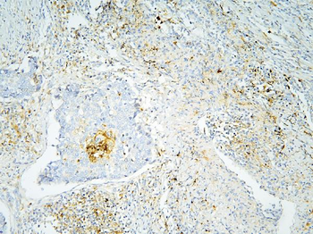 Annexin A3/ANXA3 Rabbit Polyclonal Antibody