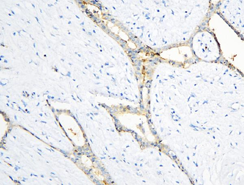 Annexin A3/ANXA3 Rabbit Polyclonal Antibody