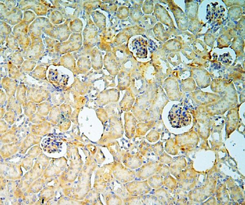 Annexin A3/ANXA3 Rabbit Polyclonal Antibody