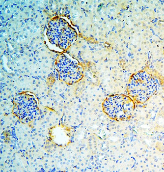 Annexin A3/ANXA3 Rabbit Polyclonal Antibody