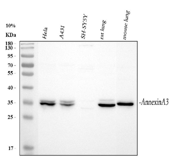 Annexin A3/ANXA3 Rabbit Polyclonal Antibody