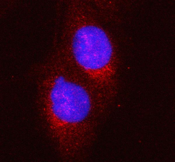 HERC5 Rabbit Polyclonal Antibody