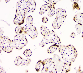 BCL9L Rabbit Polyclonal Antibody