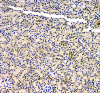 BCL9L Rabbit Polyclonal Antibody