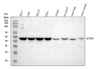 SF3B4 Rabbit Polyclonal Antibody