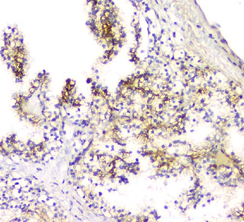SCN4B Rabbit Polyclonal Antibody