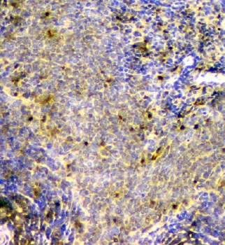 SCN4B Rabbit Polyclonal Antibody