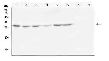 SCN4B Rabbit Polyclonal Antibody