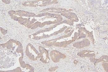 Semaphorin 3B/SEMA3B Rabbit Polyclonal Antibody
