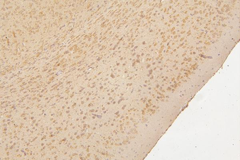 Semaphorin 3B/SEMA3B Rabbit Polyclonal Antibody