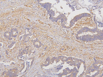 RAB3GAP2 Rabbit Polyclonal Antibody