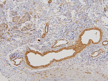 RAB3GAP2 Rabbit Polyclonal Antibody