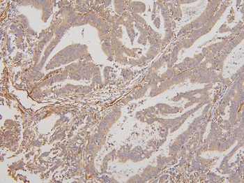 RAB3GAP2 Rabbit Polyclonal Antibody