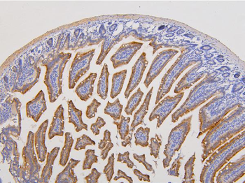 RAB3GAP2 Rabbit Polyclonal Antibody