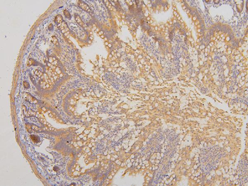 RAB3GAP2 Rabbit Polyclonal Antibody