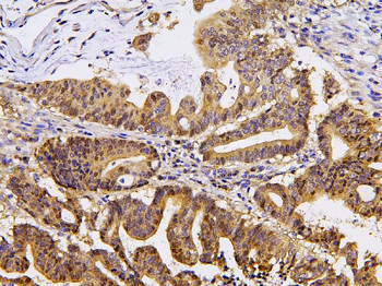 Pyrophosphatase 1/PPA1 Rabbit Polyclonal Antibody